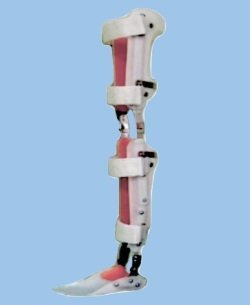 Аппарат на голеностопный и коленный суставы