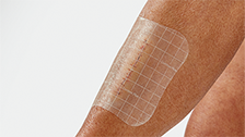 C+_USP2B_Wound_monitoring_224x126px.png