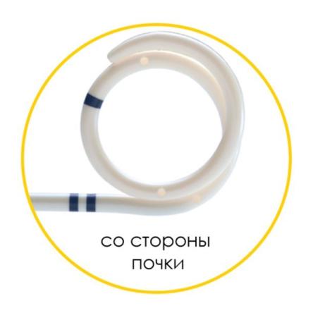 Купить Мочеточниковый стент Urotech White Star двухпетлевой мультидлина 22-30см 3