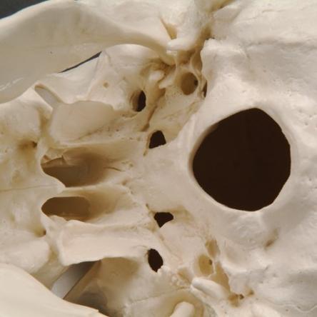 Купить Модель черепа с шейными позвонками A018 7