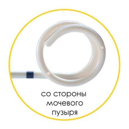 Купить Мочеточниковый стент Urotech White Star набор, двойной завиток, открытый тип, проводник 3