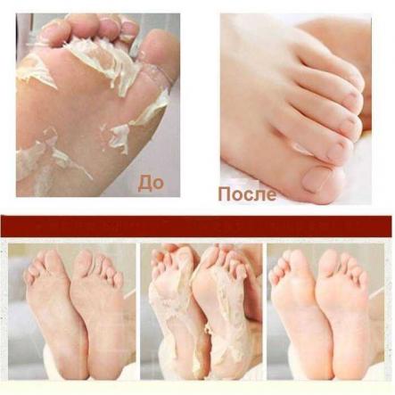 Купить Носочки для педикюра Spa Socks (GESS-051) 4