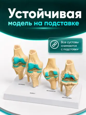 Купить Анатомическая модель коленного сустава макет заболевания суставов Retorsa 6