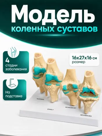Анатомическая модель коленного сустава макет заболевания суставов Retorsa