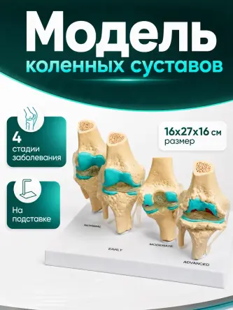 Купить Анатомическая модель коленного сустава макет заболевания суставов Retorsa 0