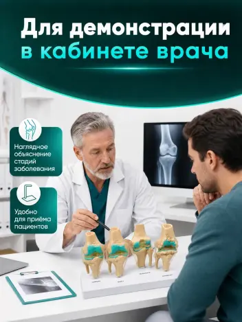 Анатомическая модель коленного сустава макет заболевания суставов Retorsa